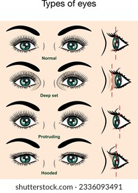 Different types of eyes. Deep set, protruding, hooded eyes. 