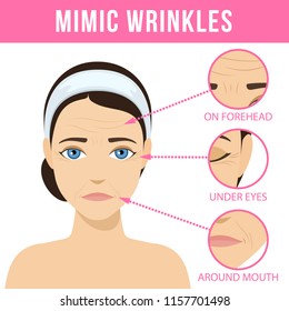 Different types of facial wrinkles. Age-related skin changes. Vector