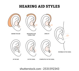 Diferentes tipos de estilos de audífonos establecen la colección, para los discapacitados auditivos y los sordos, Diferente tecnología de audífonos con detrás, receptor, en el oído, ajuste abierto, en el canal, invisible, completamente