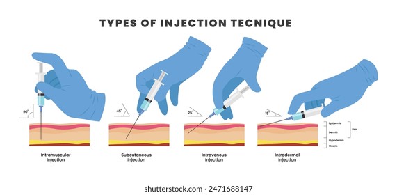 Different types of injection technique poster or medical banner scheme, with Various methods of needle jab in skin. Intramuscular, subcutaneous, intravenous and intradermal process