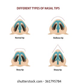 Different types of nasal tips