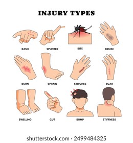 Different types of physical injury types poster for education vocabulary words with rash, splinter, bite, bruise, burn, sprain, stitches, scar, swelling, cut, bump and stiffness. Wounds and fractures.