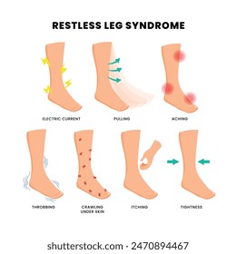 Different types of restless leg syndrome poster, medical banner infographic with electric current, pulling, aching, throbbing, crawling under skin, itching, tightness. Feet foot periodic pain ache.