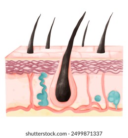 Different types of skin layers