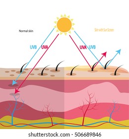 Different types of skin layers