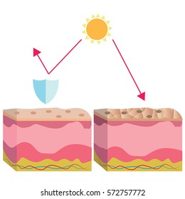 Different types of skin layers