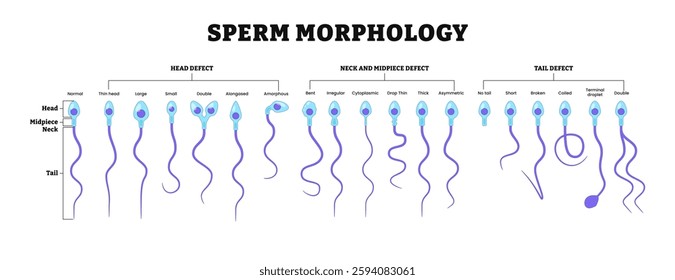 Different types of sperm morphology.  Normal, abnormal and defective human egg. Spermatozoon. Male Reproductive system. fertility diagram. Labeled head, midpiece, neck, tail defect.