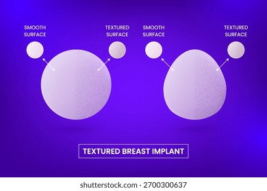 Diferentes tipos y superficies texturizadas de implantes mamarios de silicona de forma redonda y forma de lágrima. Implantes mamarios realistas para la mejora del busto. Infografía de Vector para la clínica de cirugía plástica cosmética