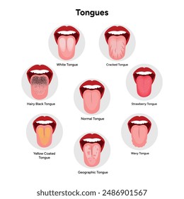 Different types tongue problem, wavy, cracked, strawberry, geographic, yellow, hairy black and white tongues