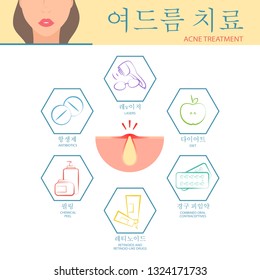 Different types treatment for skin problems the face.  Acne treatment infographics. Vector illustration.