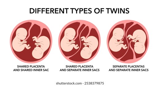 Different types of twins concept vector illustration on white background.