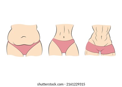 Different types of women body. Woman fat, skinny and muscle bodies. Transformation of body. Vector illustration.