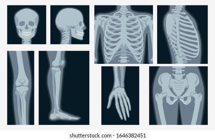 Different x-rays shot of human body part set vector flat illustration. Cartoon various x-ray pictures of head, hands, legs, torso of skeleton character isolated on white background