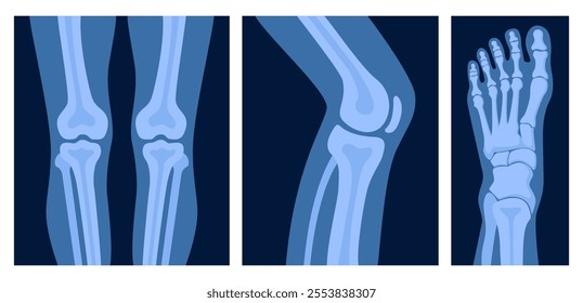 Different x-rays shot of human body part, set. Various x-ray pictures of foot, leg. Vector illustration