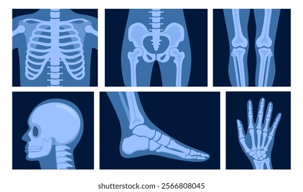 Different x-rays shot of human body part, set. Various x-ray pictures of head, hand, foot, leg, torso, chest and pelvis. Vector illustration