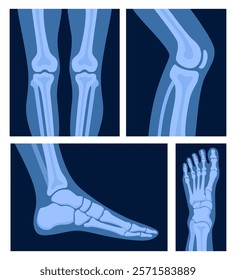 Different x-rays shot of human body part, set. Various x-ray pictures of foot, leg. Vector illustration