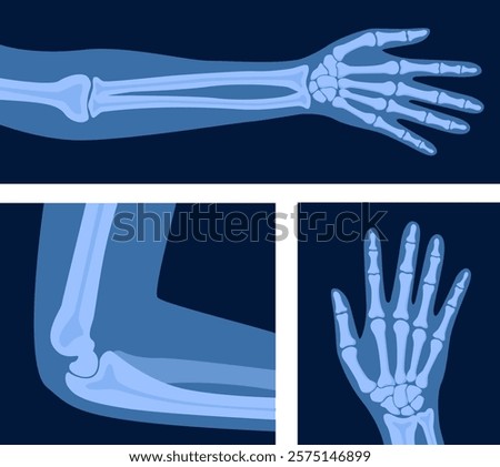 Different x-rays shot of human body part, set. Various x-ray pictures of hand, arm, elbow. Vector illustration