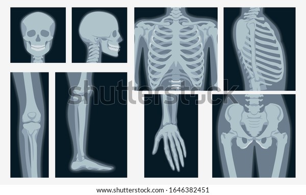 Different Xrays Shot Human Body Part Stock Vector Royalty Free