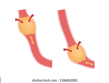 Digestion and Peristalsis vector / intestine