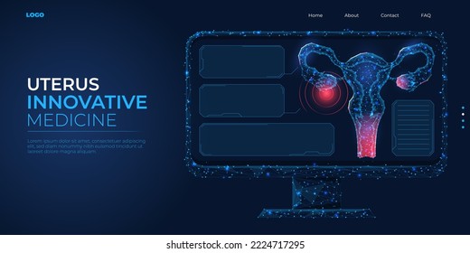 Digital 3d Low Poly Model Female Uterus. Wireframe Concept Of Women's Health, Gynecology And Reproductive System. Abstract Background Vector Illustration.