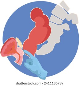 digital rectal examination for diagnosis of bph or prostatic cancer 