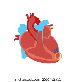 Dilated Cardiomyopathy, Cardiovascular Disease Illustration Icon