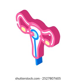 dilatação e curetagem cirurgia ícone isométrico vetor. dilatação e curetagem sinal de cirurgia. ilustração de símbolo isolado