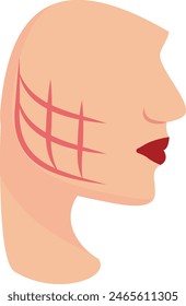 Dimple Creation Surgery concept, buccal fat removal vector flat design, plastic surgeon Symbol, body contouring Sign, Beauty treatment stock illustration