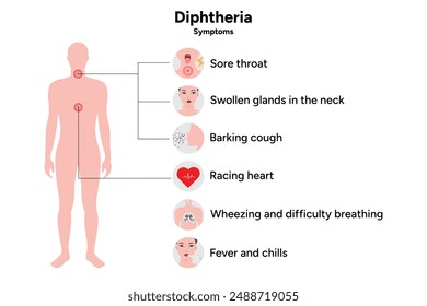 Diphtheria symptoms medical information with human silhouette illustration