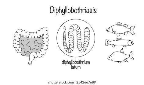 Diphyllobothriasis. Parasitic infestation by tapeworms with intestinal damage. Hand-drawn disease diagram. Most often, a person becomes infected by eating infected fish. Vector illustration.