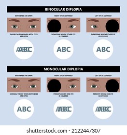 Diplopia double vision test exam brain nerve dry eye palsy gravis muscle loss head brain tumor squint ptosis gaze myopia miosis tropia Phoria maddox rod horner's ocular amblyopia Lazy stroke abducens