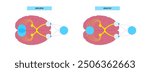 Diplopia medical poster. Double vision disease, eye muscle weakness or nerve damage. Simultaneous perception of two images of a single object. Connection with human brain and eye vector illustration