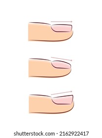 direction of nail growth, different types of fingernail, flat, convex and concave nails, nail extension guide, manicure vector illustration