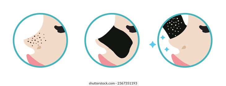 Direction for use blackhead pore strip treatment vector icon set illustration on white background. How to use blackhead removal nose pore strip and reveal beauty skin. Before and after concept.