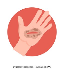 Dirt In The Wound On Hand Vector Illustration