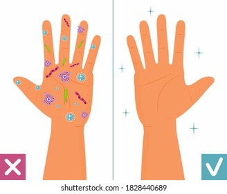 Dirty and clean hands. Hygiene body, infection control against colds, flu, corona-virus. Bacteria on skin is shown.
