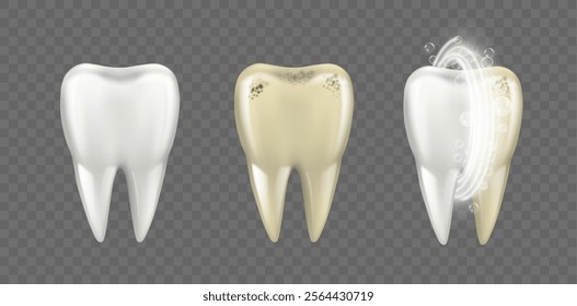 Dirty and clean realistic teeth with roots, dental care and protection for tooth. Vector whitening and hygienic cleansing, reducing bacteria and yellowness. Medicine and healthcare in clinic