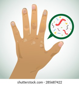 Dirty hand and image caused by infection.