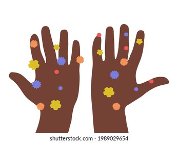 Dirty hands illustration. Hands palms full with bacteria and viruses. African american ethnicity. Hygiene awarness icon. Vector.