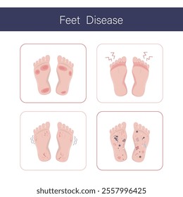 Dirty human bare foot, various microorganisms and bacterias on feet. Unsanitary conditions, various pathogens and parasites on unwashed footstep. Health care, microbiology. Flat vector illustration