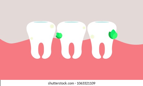 Dirty teeth with food scraps