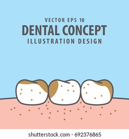 Dirty teeth illustration vector on blue background. Dental concept.