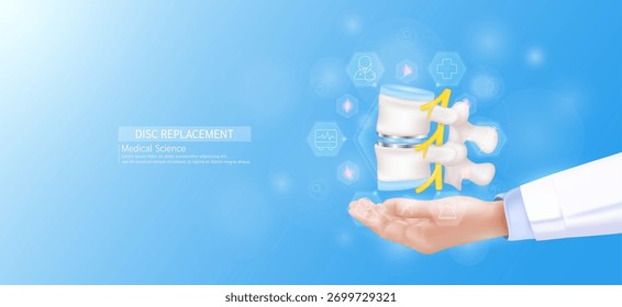 Modelo de reemplazo de disco en mano del médico. Articulación ósea de la vértebra rodeada de iconos médicos. Tecnologías en la ciencia y la salud. Vector 3D realista.