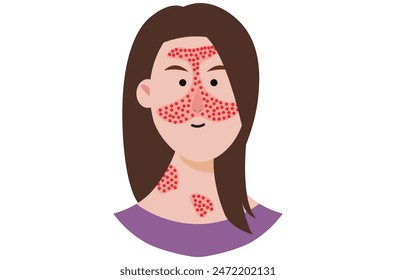 Discoid lupus erythematosus is a chronic skin condition causing red, inflamed, scaly patches. Similar diseases include systemic lupus erythematosus (SLE), subacute cutaneous lupus, and lichen planus.