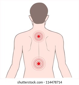 disease back and neck pain