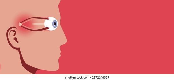 Disease blindness. Anatomical vector stock illustration with space for text. Persona and disease fibroids, glaucoma. Pain in body. Copy Space Template