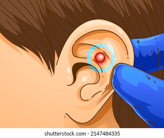 The disease of the ear. Big pimple on the ear. Bug bite. Skin problems. Medical illustration. Healthcare illustration. Vector illustration.