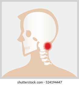 Disease of  head and neck, the joints and bones,human joints, skeletal spinal bone structure of Human Spine, medical health care flat vector illustration.