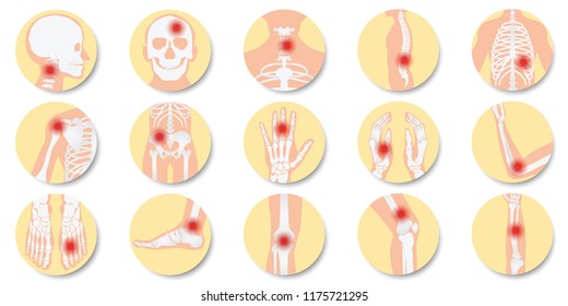 Disease of the joints and bones icon set on white background, bone x-ray image of human joints, anatomy skeleton flat design vector illustration.