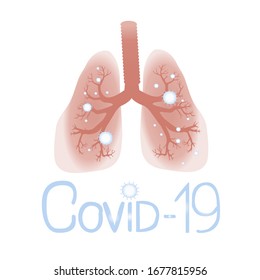 
 Krankheit. Lungen, die durch Coronavirus (Covid-19), Pneumonie, Pandemie hervorgerufen werden.
 Vektorillustration.